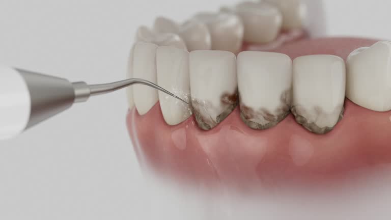 Reliable Dental contractor in Vinton County County, OH by Dentist Open Now